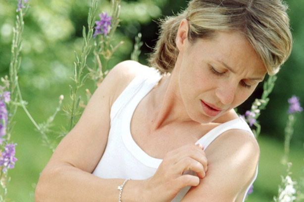 Insect Bite woman itch skin rash