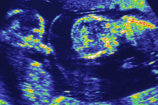 Twins IVF