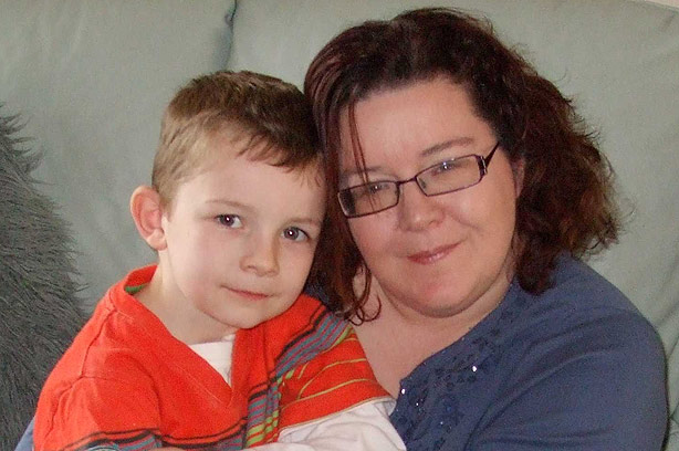 Debbie O'Keeffe - living with eczema