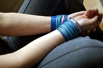 Self harming