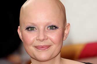 Gail Porter's hair has started to grow back