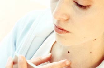 A woman checking a mole