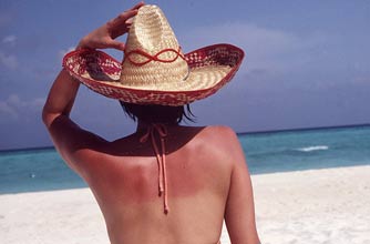 Sunburnt woman on the beach