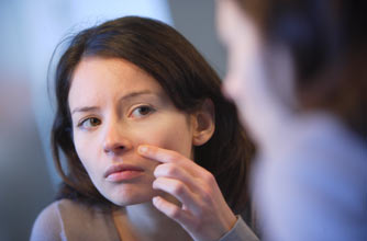 Adult woman with spots, bad skin, acne