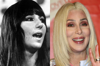 Cher, teeth Cher, teeth