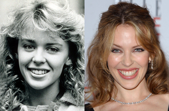 Kylie Minogue, teeth Kylie Minogue, teeth