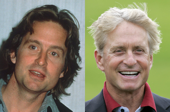 Michael Douglas, teeth Michael Douglas, teeth