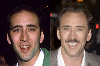 Nicolas Cage, teeth Nicolas Cage, teeth