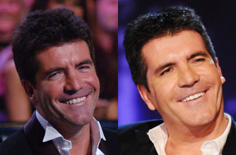 Simon Cowell, teeth Simon Cowell, teeth