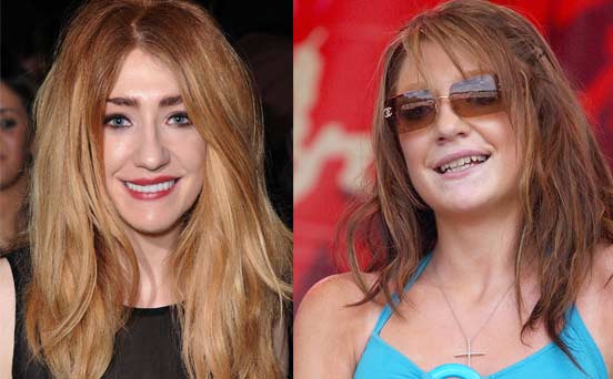 Celebrity teeth: before and after - Nicola Roberts - goodtoknow