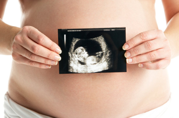 Pregnant woman with an ultrasound scan picture