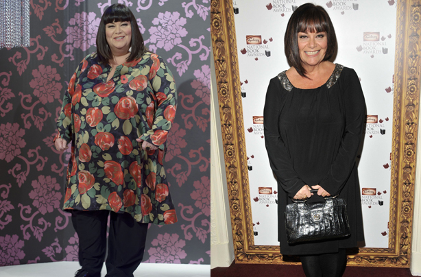 Dawn French