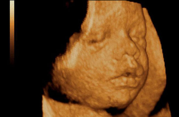 3D pregnancy image 3D pregnancy image