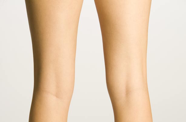Back of woman's legs Back of woman's legs