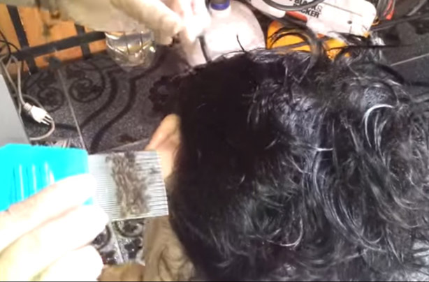 Head lice video