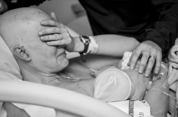 Breastfeeding mum after mastectomy