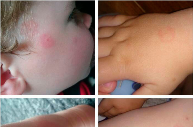Karen McGregor Lyme disease Facebook post