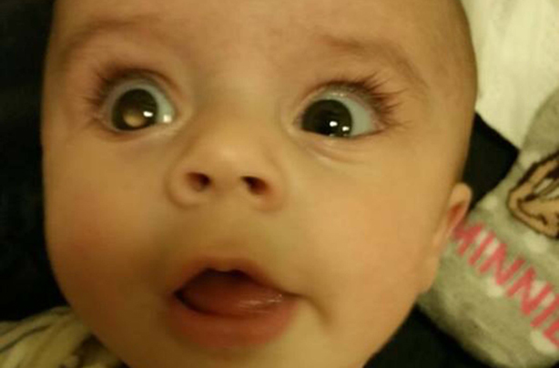 Vicky Ashall baby eye cancer