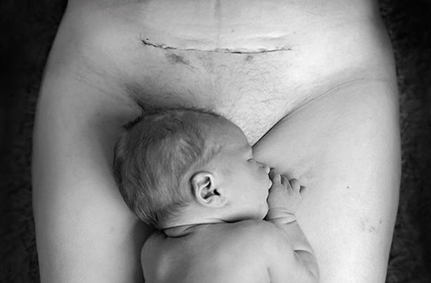 Helen Carmina Photography C-section scar viral picture