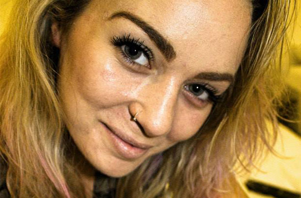 Giorgia Lanuzza psoriasis story