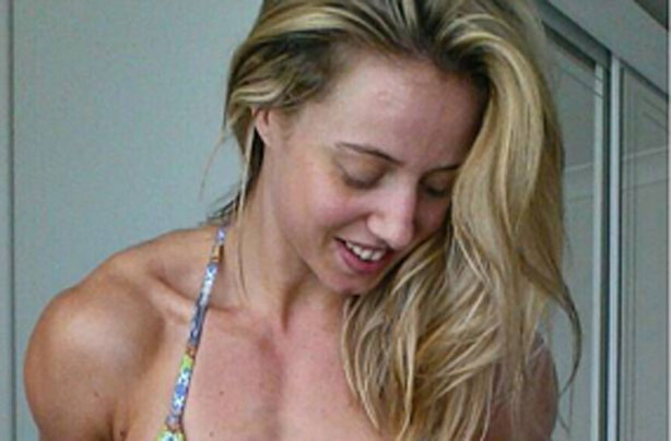 Crohns disease bikini selfie