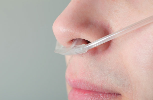 nose tube, patient, sick, KEN diet