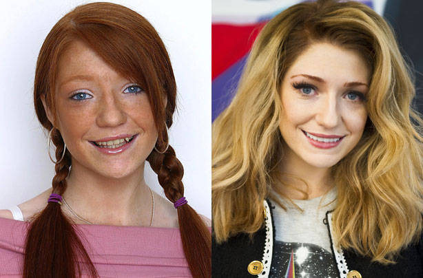 Nicola Roberts' teeth Nicola Roberts' teeth