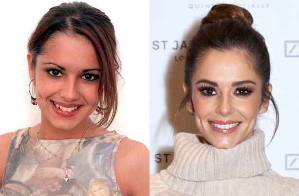 Cheryl Cole's teeth Cheryl Cole's teeth