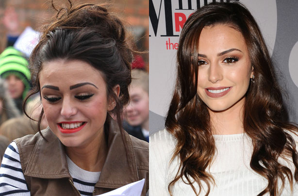 teeth cher lloyd before celebrity goodtoknow celeb