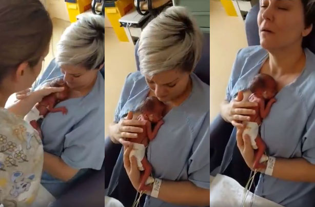 Premature baby love what matters