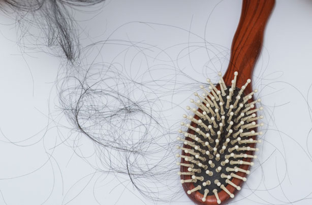hair loss alopecia