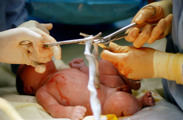 Delayed cord clamping