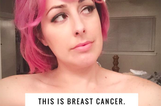 Christi breast cancer viral