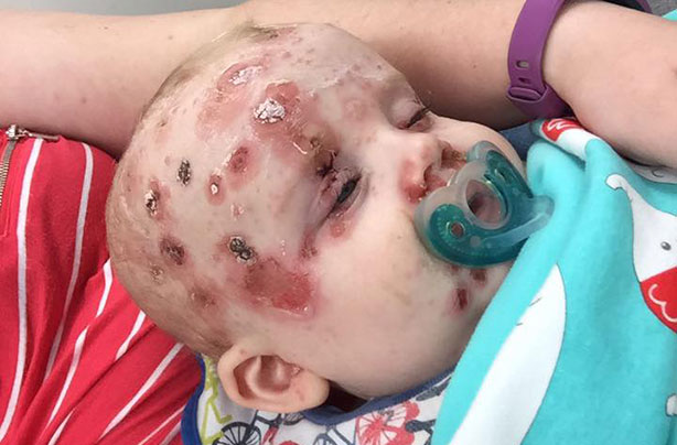 Kayley Burke, viral chicken post vaccination post