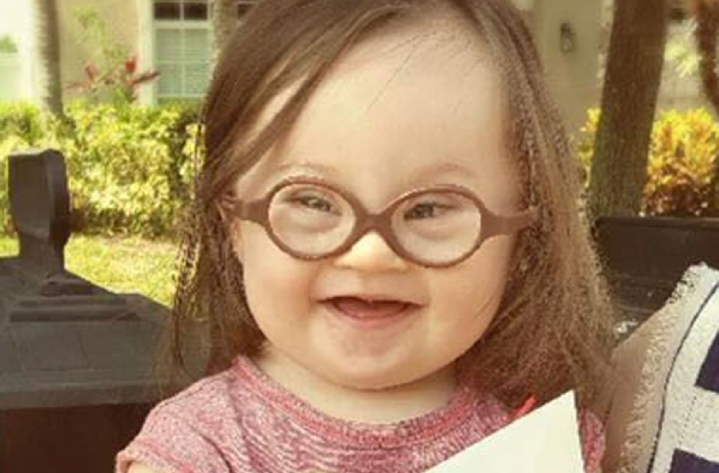 Down syndrome Emmy