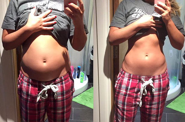 Tiffany Brien, bloated stomach