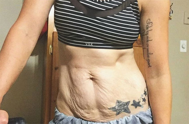 Marissa Fearon, viral post-baby body pictures