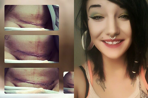 C-Section mum facebook post