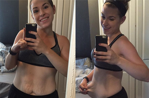 Weight loss mum