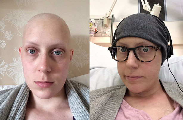 Bride to be with ovarian cancer