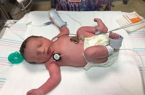 Baby born twice Lynlee Hope