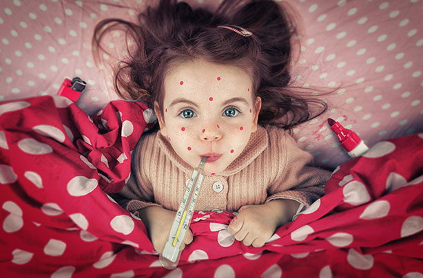 Measles
