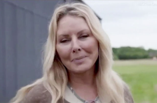 Carol Vorderman puffy face